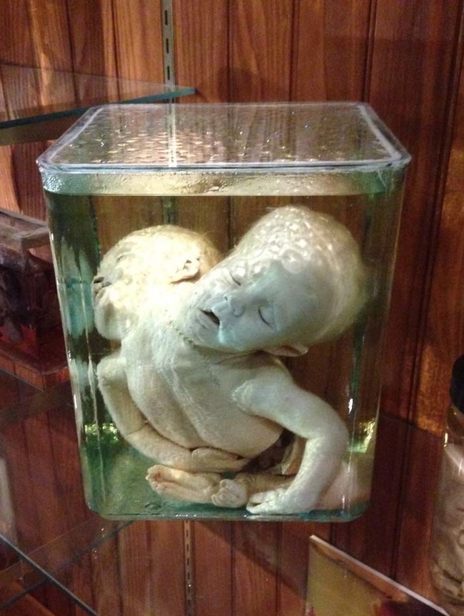 Mutter Museum -- Philadelphia